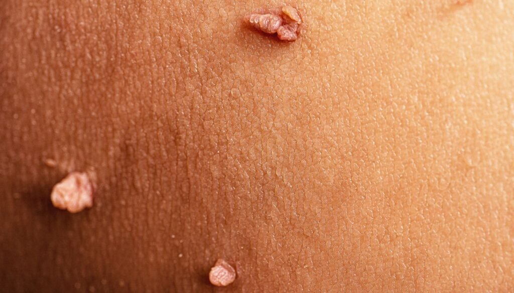 HPV STD TESTING PLAYA DEL CARMEN TULUM